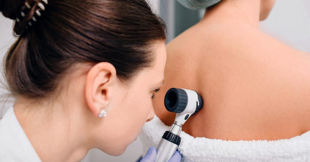 5 Reasons You Need to See a Dermatologist