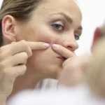 Woman examining and squeezing acne on her face in the mirror, representing common skin concerns treated by a dermatologist in Jacksonville at a professional skin care clinic