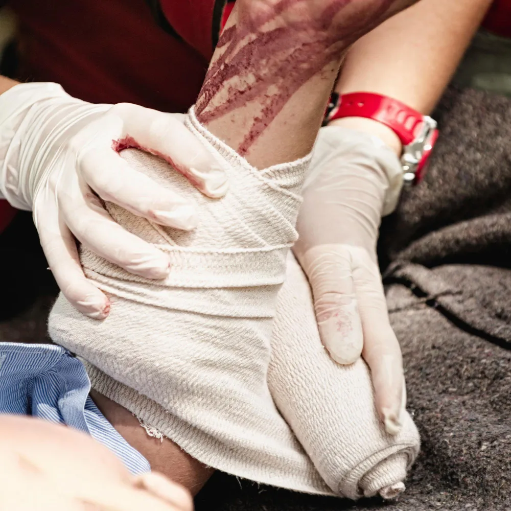 Close-up of a healthcare professional dressing a bleeding wound, highlighting emergency and specialized care provided at a wound care clinic for effective wound cleaning treatment and infection prevention